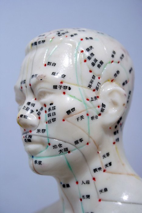 Accupuncture Model