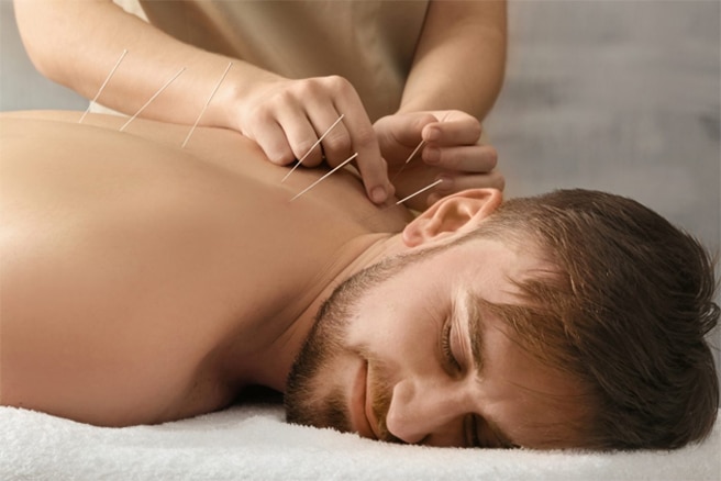 Acupuncture Therapies